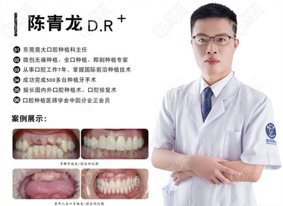 东莞寮步莞大口腔种植主任陈青龙 东莞寮步莞大口腔种植主任陈青龙