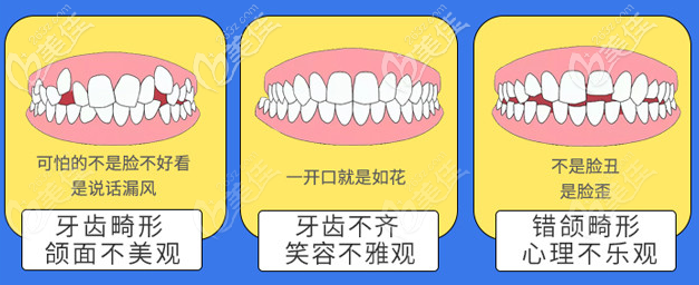 北京壹加壹口腔擅长各种牙齿畸形矫正 北京壹加壹口腔擅长各种牙齿畸形矫正