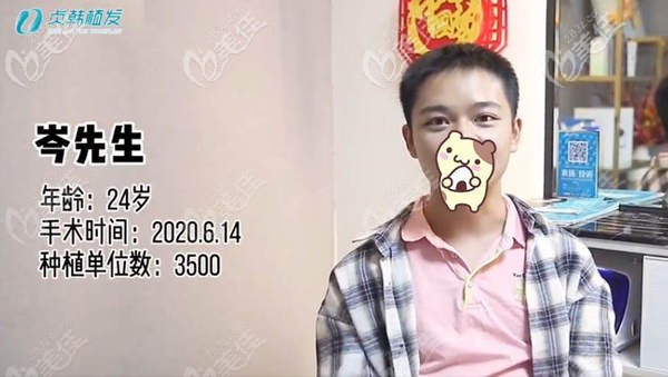 玉林贞韩发际线种植3500毛囊术后效果图 玉林贞韩发际线种植3500毛囊术后效果图