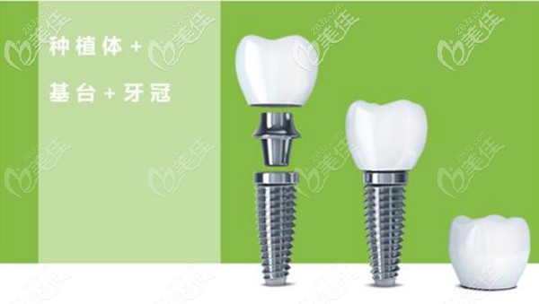 江医生擅长牙齿缺失种植 江医生擅长牙齿缺失种植