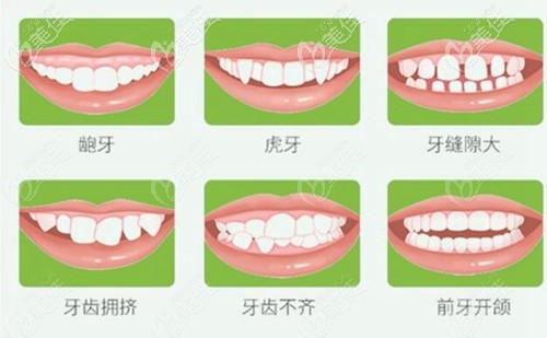 时代天使隐形矫正的项目