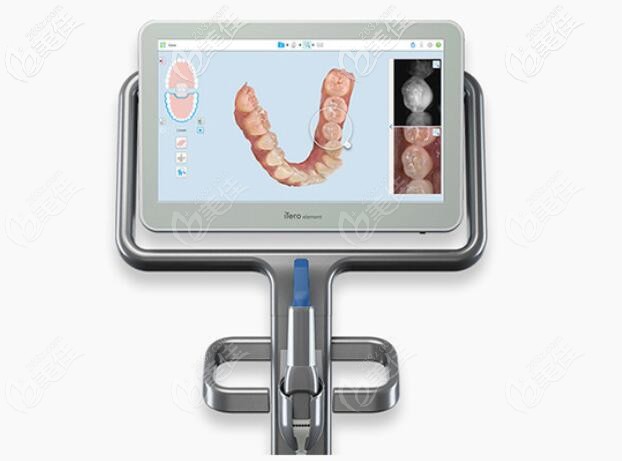 全隐形牙齿矫正3D扫描数字化<span style= 全隐形牙齿矫正3D扫描数字化<span style=