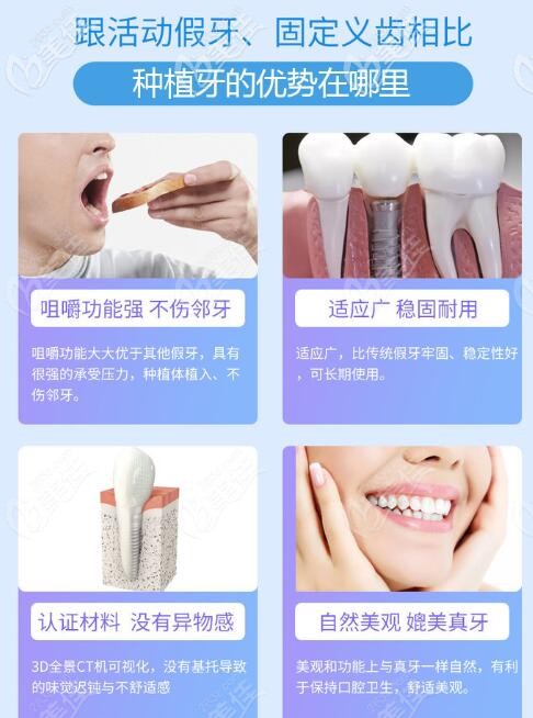 上海正丰口腔陶瓷半隐形矫正价格8999元起，歪牙变美不香吗？