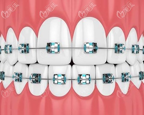 徐洋医生牙齿正畸矫正优势 徐洋医生牙齿正畸矫正优势