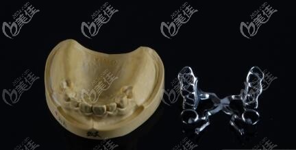 美国维他灵支架