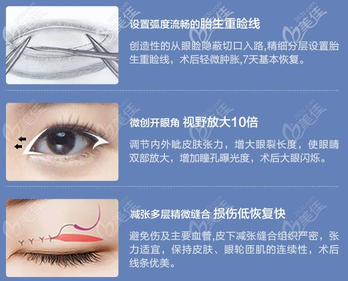 东莞科医能何建峰双眼皮优势 东莞科医能何建峰双眼皮优势