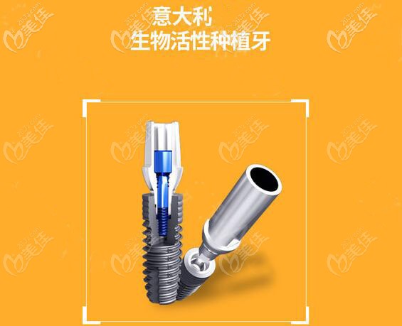 意大利种植牙怎么样