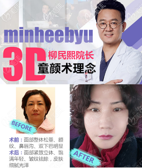 北京华韩柳民熙做拉皮怎么样