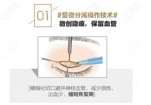 朱建莹眼部整形缝合技术 朱建莹眼部整形缝合技术