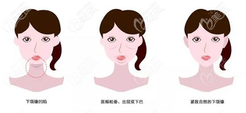 下颌缘的不同情况 下颌缘的不同情况
