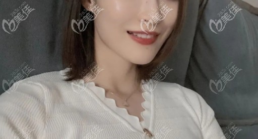 分享一波我在杭州美莱口腔戴钢丝固定牙套改变上牙前凸的正畸案例，是拔牙矫正哦！