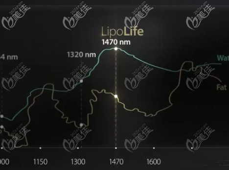 1470NM波长 1470NM波长
