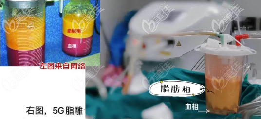 脂肪纯度高 脂肪纯度高