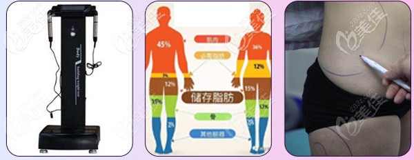 成都恒博天姿科学测脂，个性化抽脂