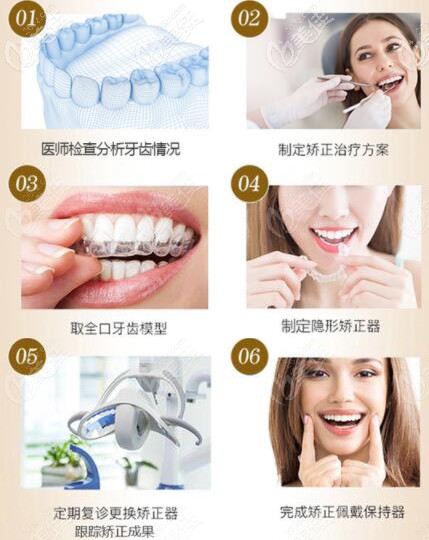 合肥壹加壹牙齿矫正全流程