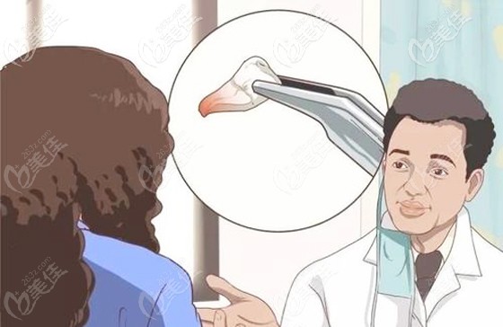 关于正畸拔牙的介绍