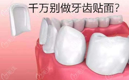 牙齿贴面好不好 牙齿贴面好不好