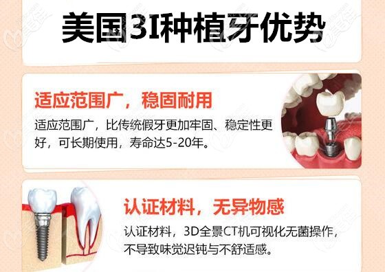 美国3i种植牙优势