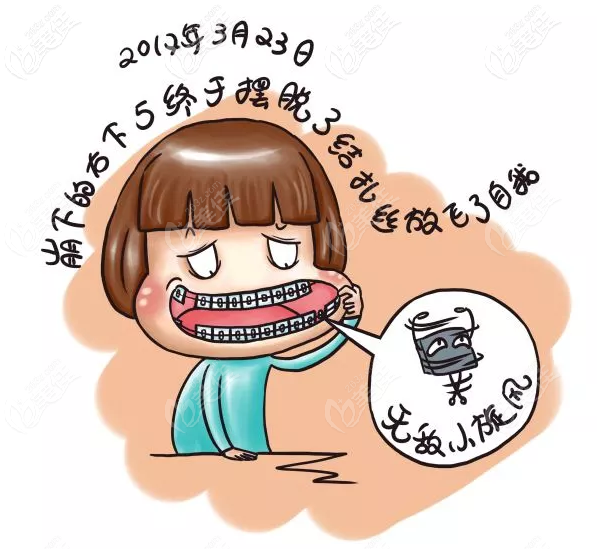 儿童适合戴传统钢牙套还是隐形牙套 儿童适合戴传统钢牙套还是隐形牙套