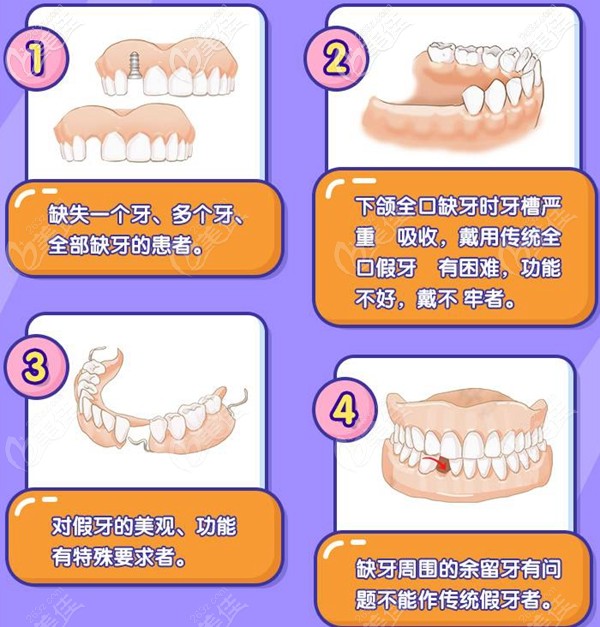 种植牙可以改善的牙齿问题