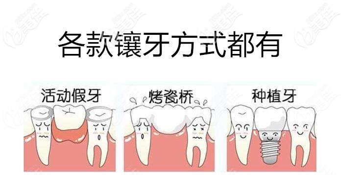 沈阳欢乐口腔各种镶牙方式都有 沈阳欢乐口腔各种镶牙方式都有