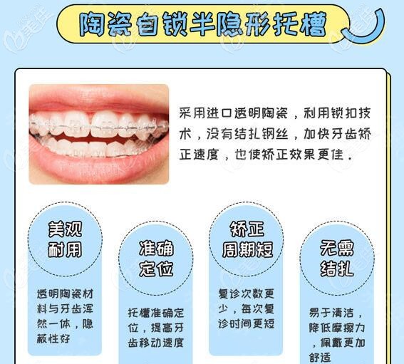 梅州中大口腔半隐形陶瓷自锁托槽 梅州中大口腔半隐形陶瓷自锁托槽