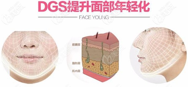 北京南加DGS四维青春复原术 北京南加DGS四维青春复原术