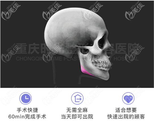 重庆时光姜民范磨骨特色