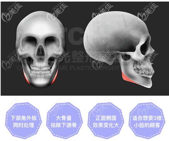 重庆时光姜民范磨骨优势