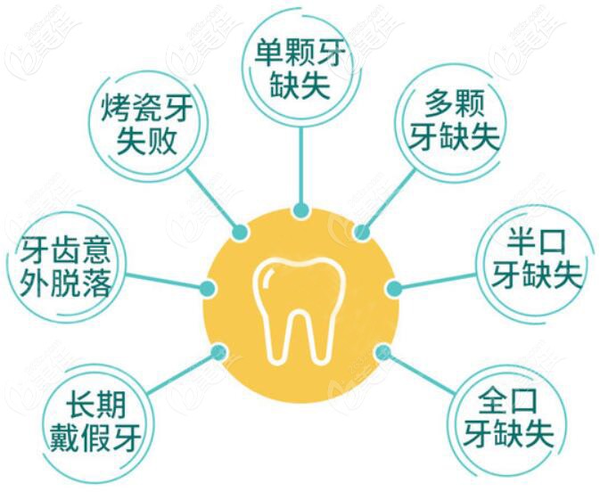 需要做种植牙的人群 需要做种植牙的人群