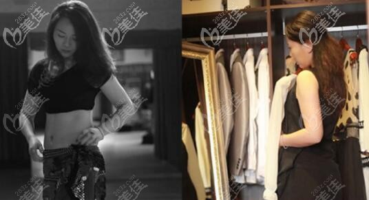 隆胸前胸部状态:产后乳房萎缩变形 隆胸前胸部状态:产后乳房萎缩变形