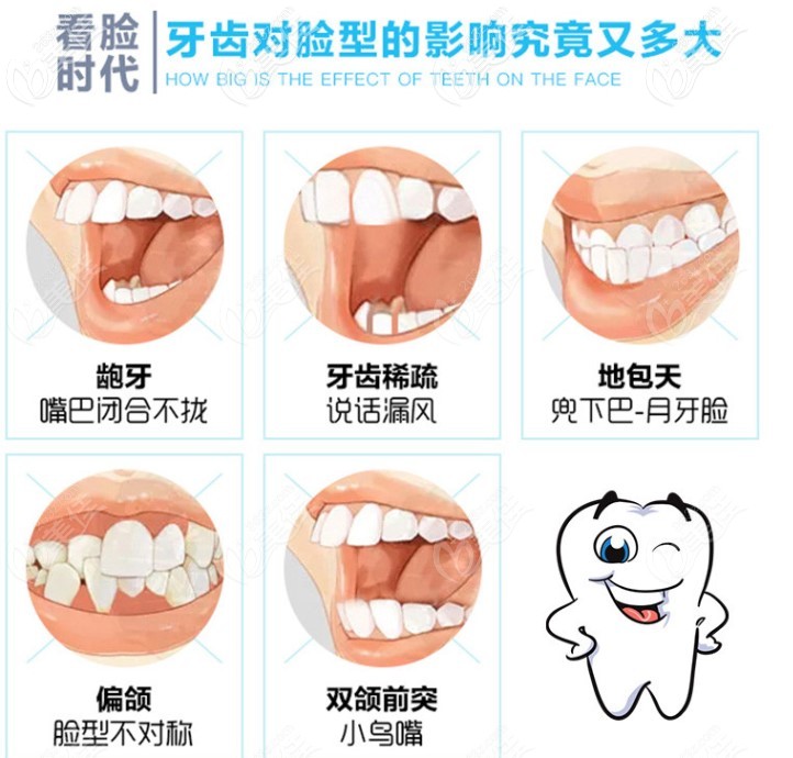 牙齿畸形对脸型的影响