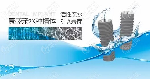 国产康盛亲水种植体