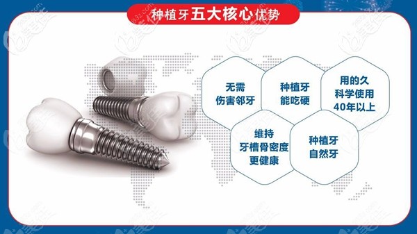 种植牙是恒信口腔的特色项目之一 种植牙是恒信口腔的特色项目之一