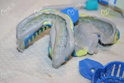 隐形矫正的复杂手术过程