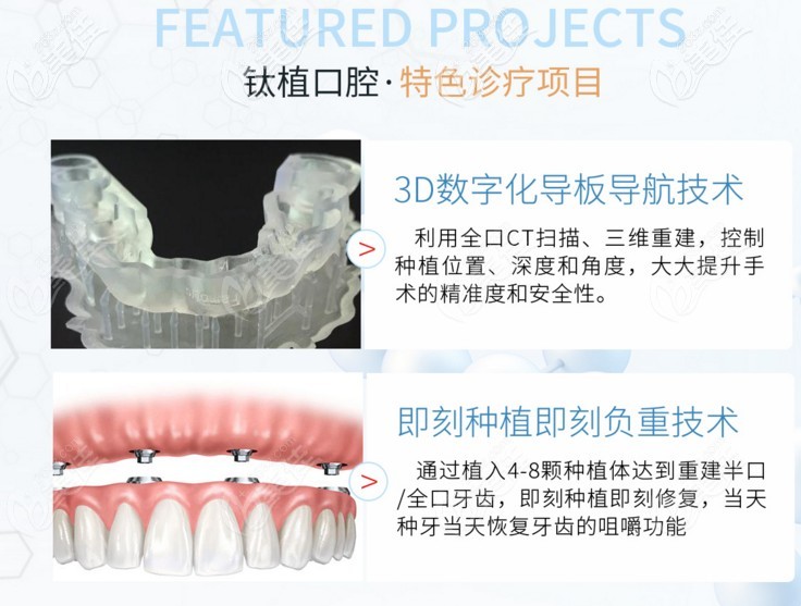 钛植口腔两大特色种植牙技术介绍