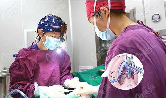 深圳富华高静隆鼻怎么样手术过程图 深圳富华高静隆鼻怎么样手术过程图