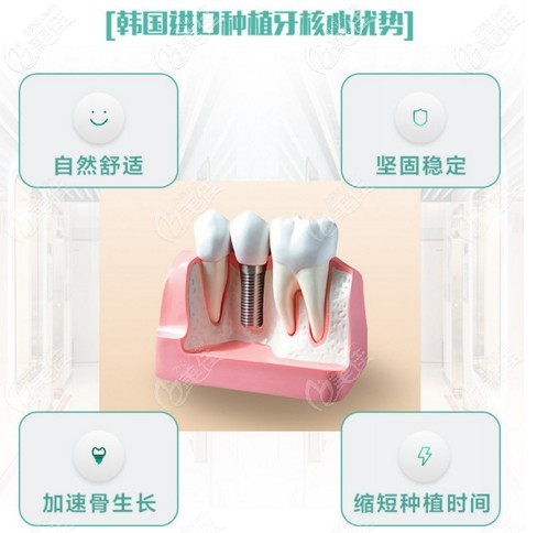 登腾种植牙优势