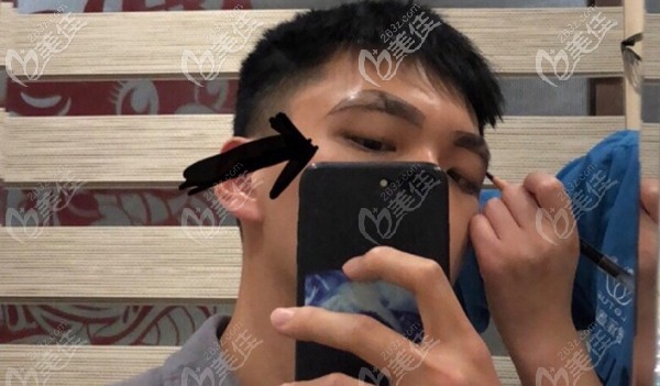 提取设计好的眉毛种植区域 提取设计好的眉毛种植区域