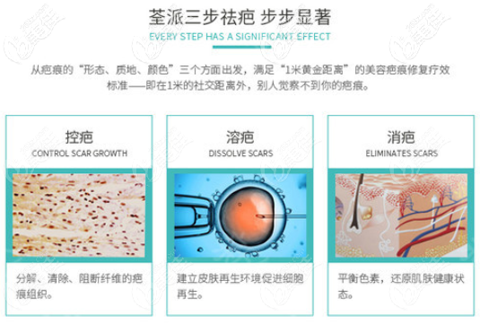 荃派三步祛疤术 荃派三步祛疤术