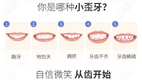 牙齿畸形的不同类型