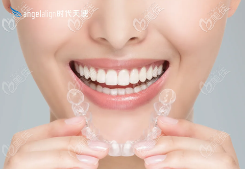 时代天使隐形矫正器 时代天使隐形矫正器