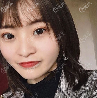 我之前在深圳博爱曙光做过手术,白云医生整形技术蛮好的