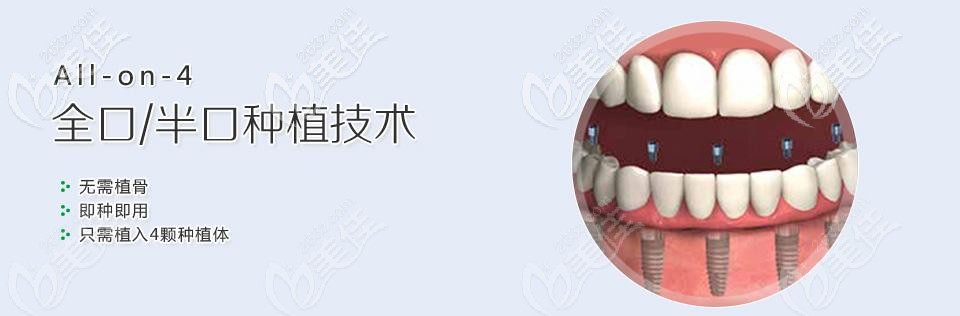 全口半口种植图片