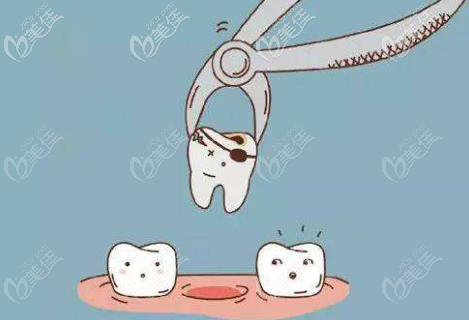 拔牙过程