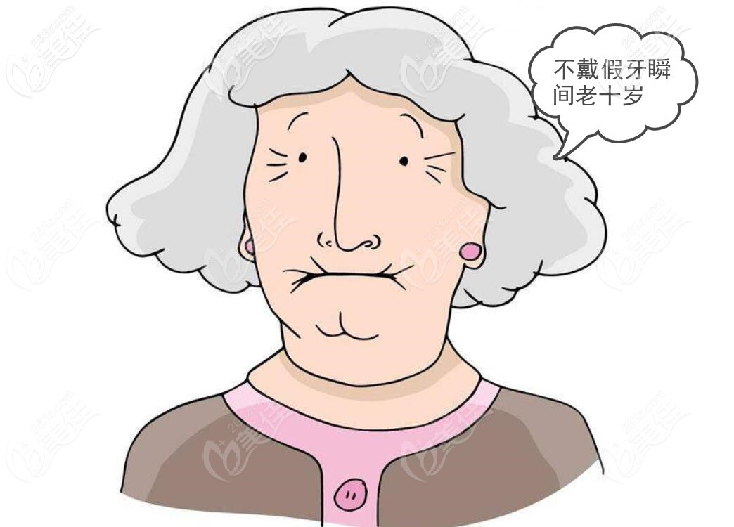 去掉全口假牙显老