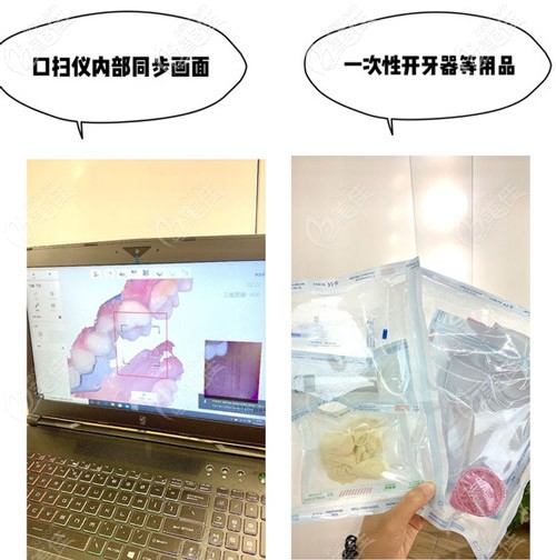 用的都是一次性开牙器