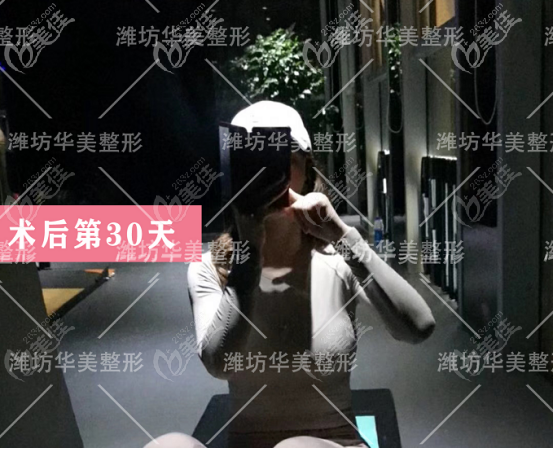潍坊华美做隆胸的术后第30天状态