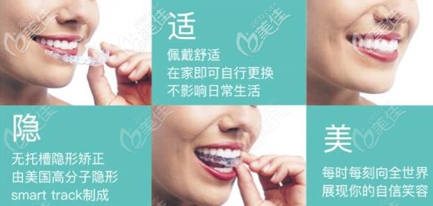 隐适美隐形牙套 隐适美隐形牙套