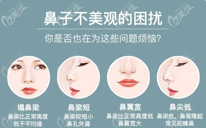 广州荔湾区人民医院常辉彦擅长各种鼻整形